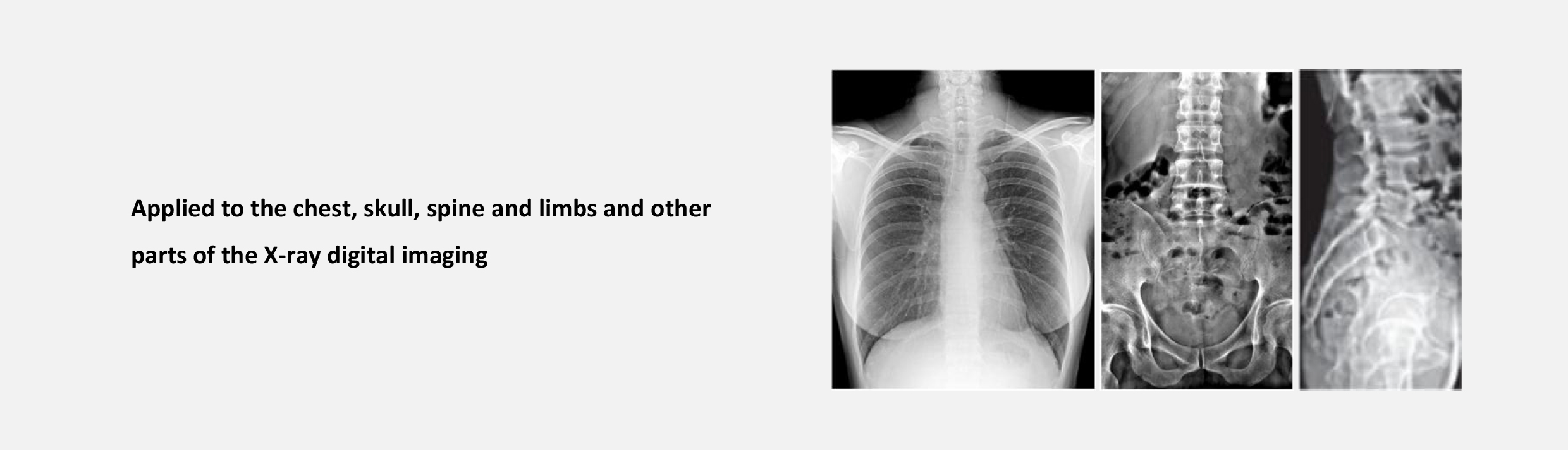 Raecho RLX8200 Digital X-ray-1.jpg
