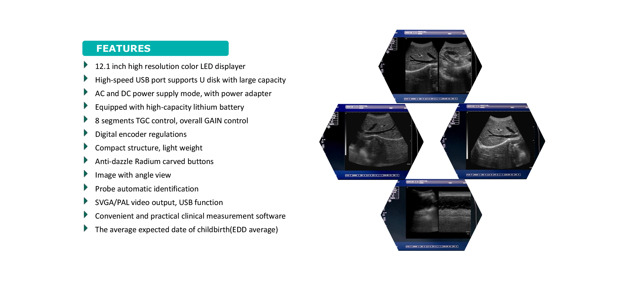 Raecho-Laptop Full Digital Ultrasound Scanner-RUF50-1.jpg