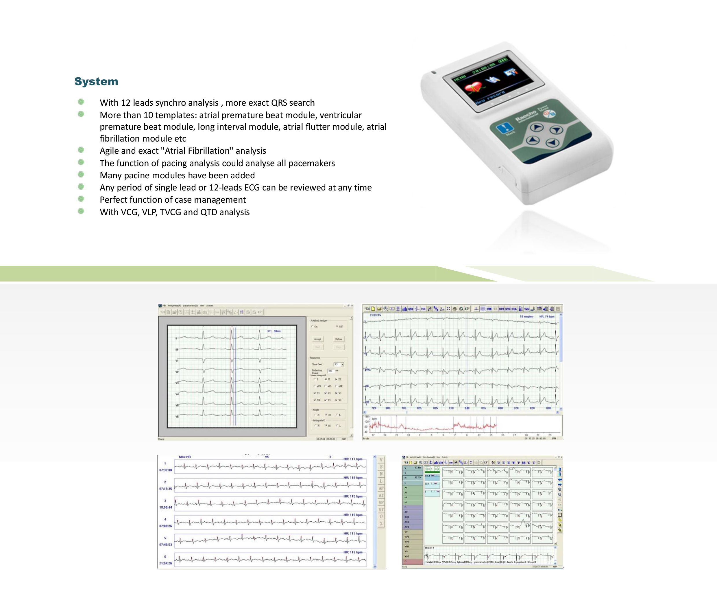 Raecho-Holter ECG -2.jpg