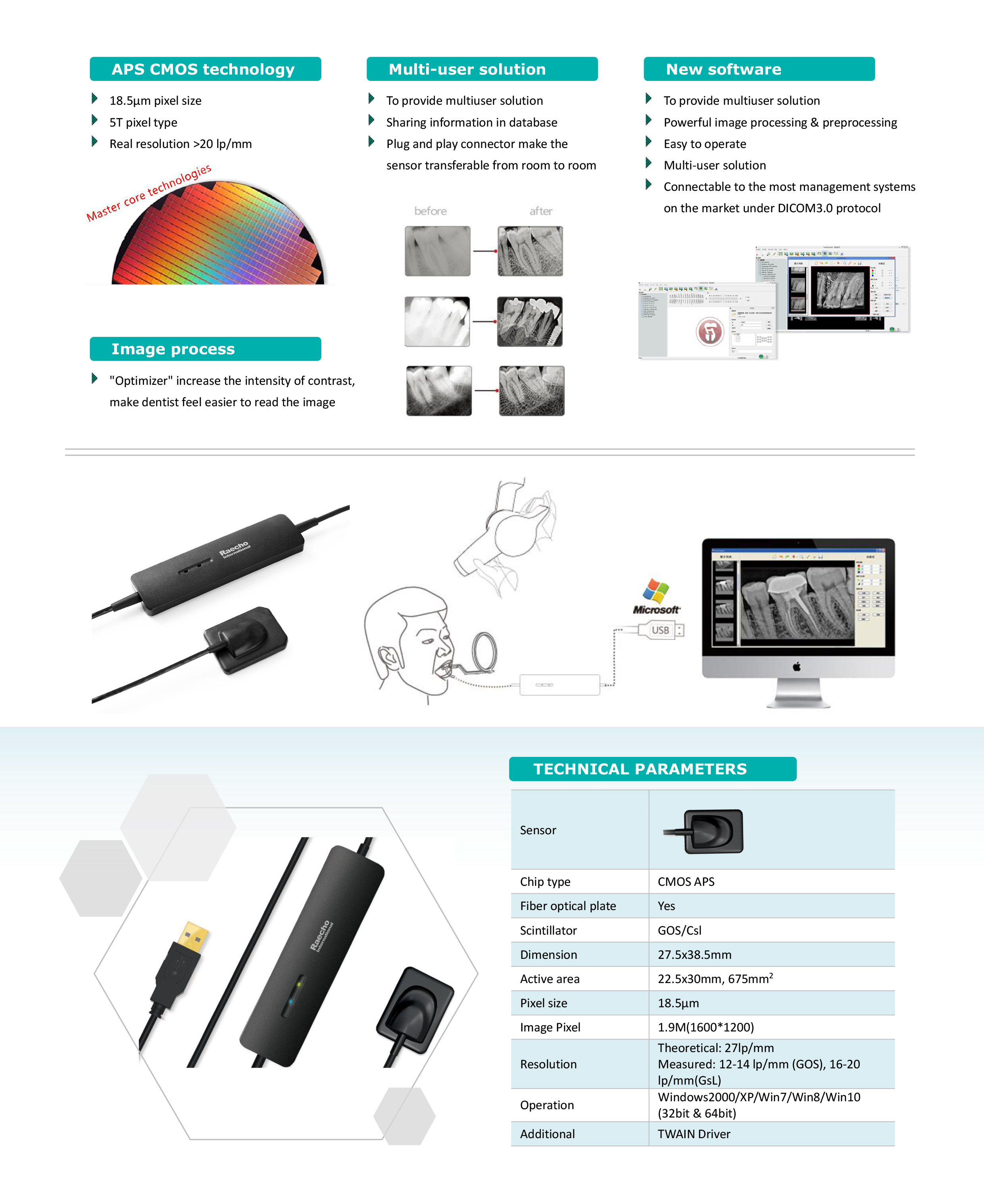 Raecho-RVG Dental Sensor-1.jpg